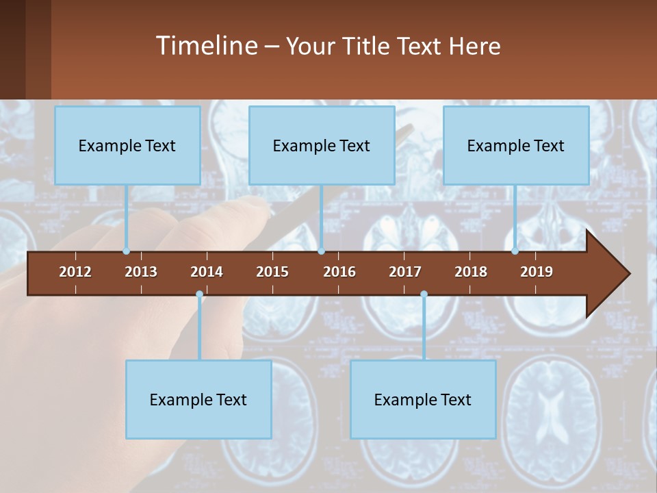 A Person Holding A Pen In Front Of A Brain Scan PowerPoint Template