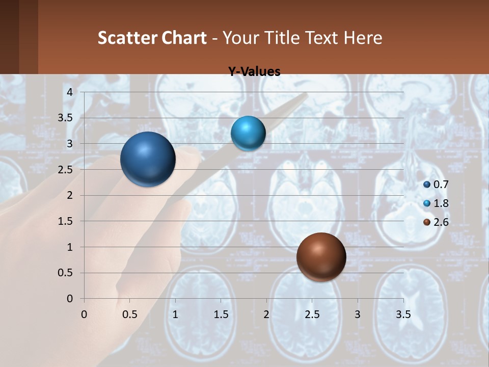 A Person Holding A Pen In Front Of A Brain Scan PowerPoint Template