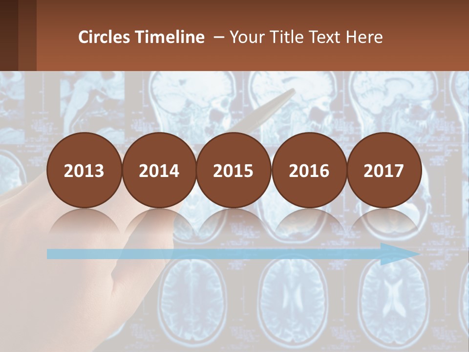 A Person Holding A Pen In Front Of A Brain Scan PowerPoint Template