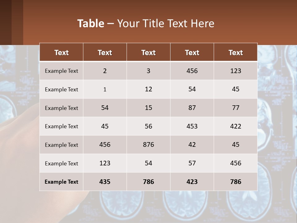 A Person Holding A Pen In Front Of A Brain Scan PowerPoint Template