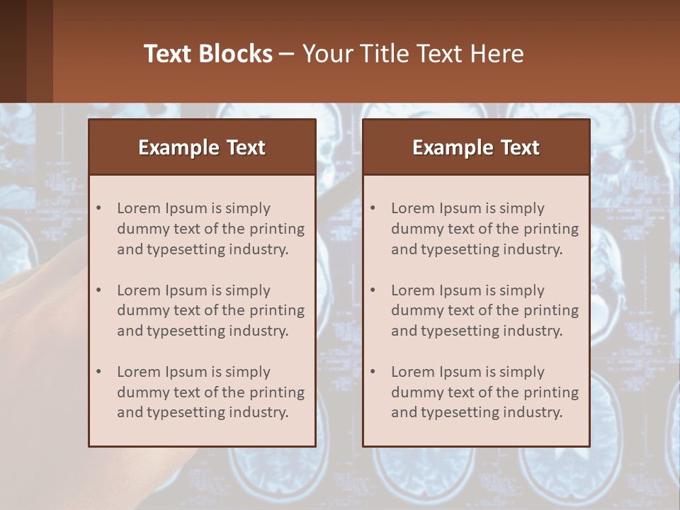 A Person Holding A Pen In Front Of A Brain Scan PowerPoint Template