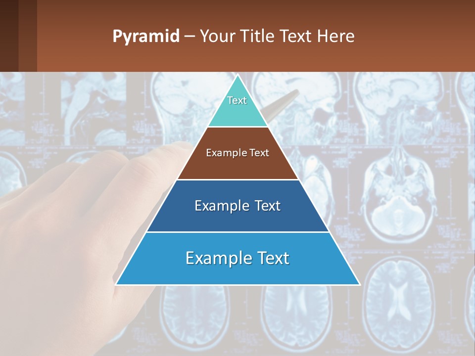 A Person Holding A Pen In Front Of A Brain Scan PowerPoint Template