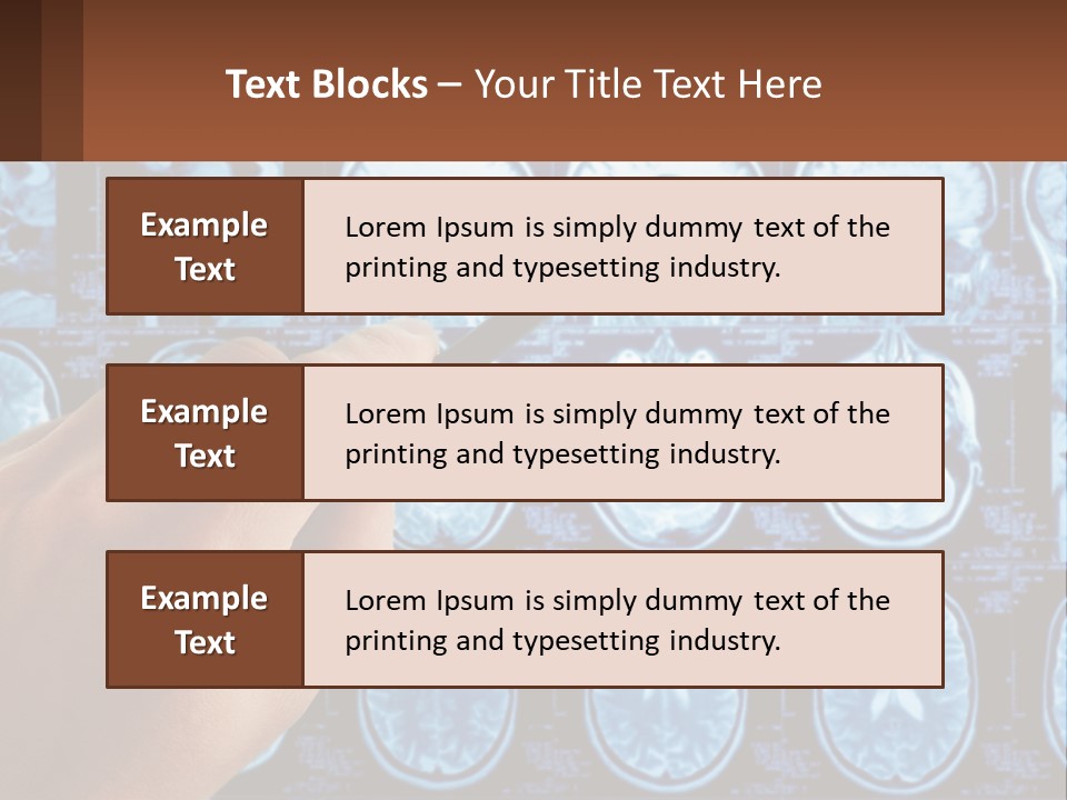 A Person Holding A Pen In Front Of A Brain Scan PowerPoint Template