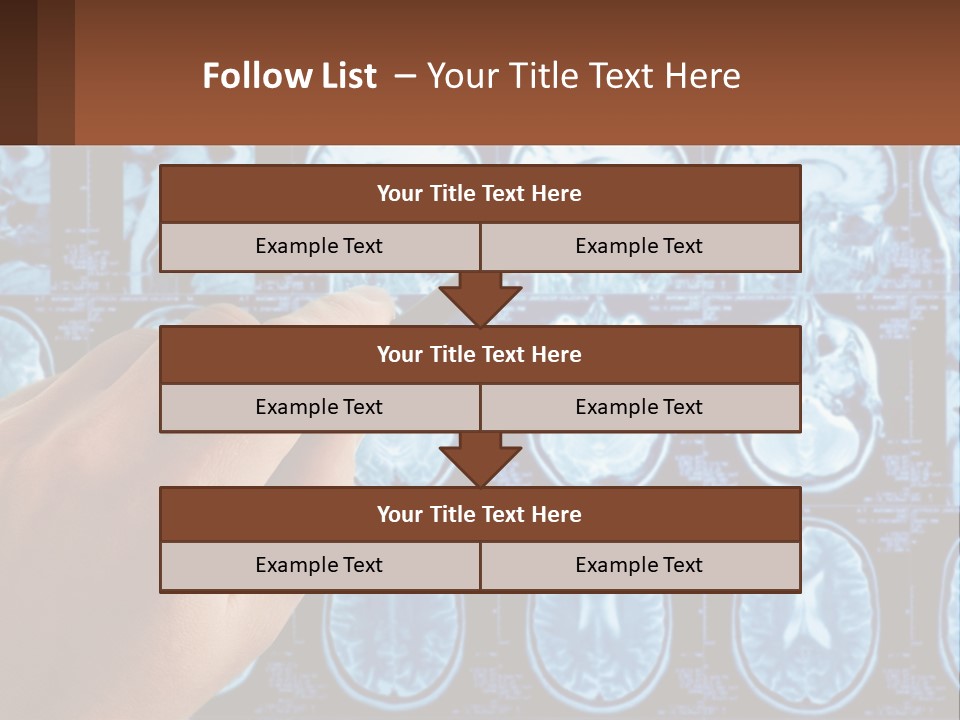 A Person Holding A Pen In Front Of A Brain Scan PowerPoint Template