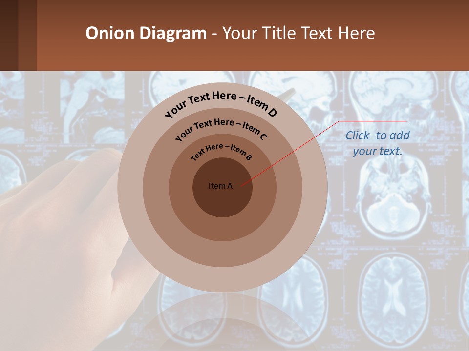 A Person Holding A Pen In Front Of A Brain Scan PowerPoint Template