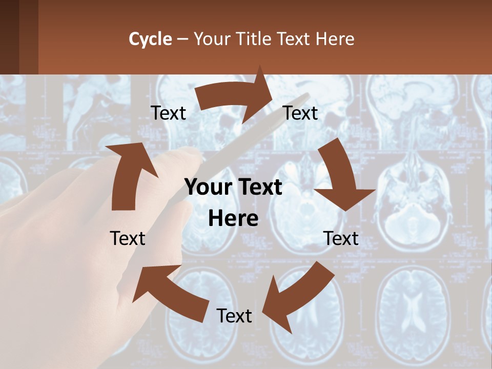 A Person Holding A Pen In Front Of A Brain Scan PowerPoint Template