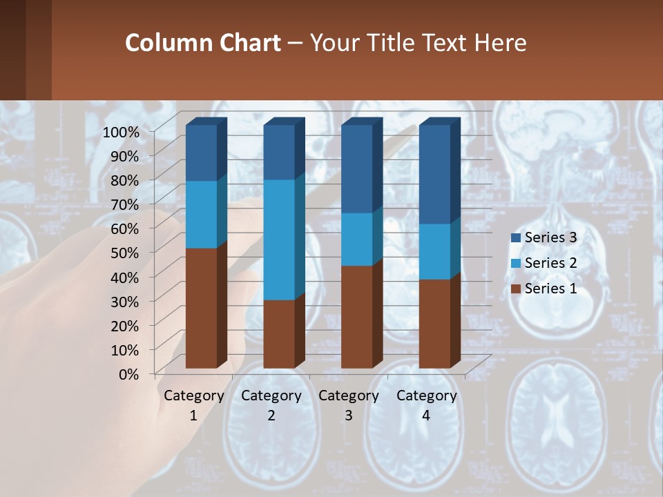 A Person Holding A Pen In Front Of A Brain Scan PowerPoint Template
