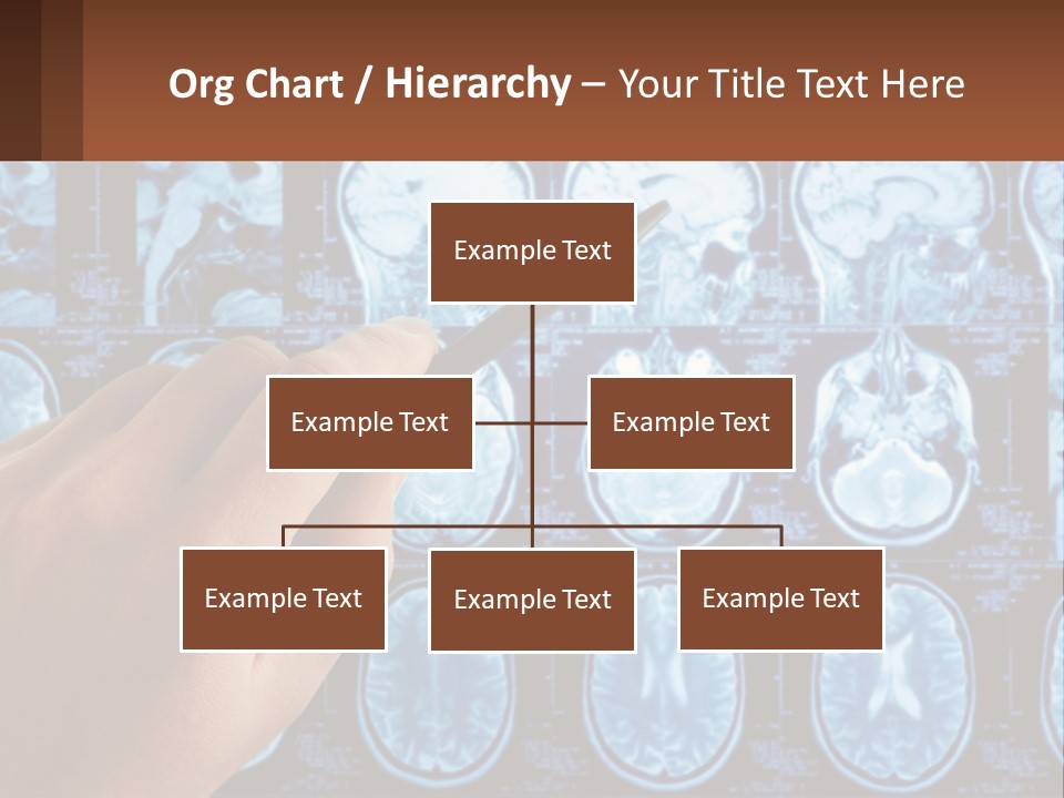 A Person Holding A Pen In Front Of A Brain Scan PowerPoint Template