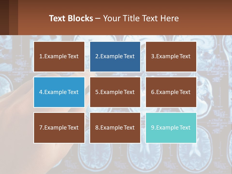A Person Holding A Pen In Front Of A Brain Scan PowerPoint Template