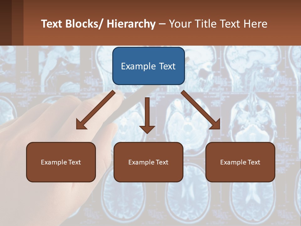 A Person Holding A Pen In Front Of A Brain Scan PowerPoint Template