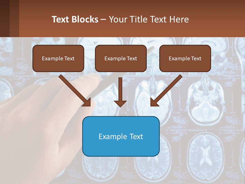 A Person Holding A Pen In Front Of A Brain Scan PowerPoint Template