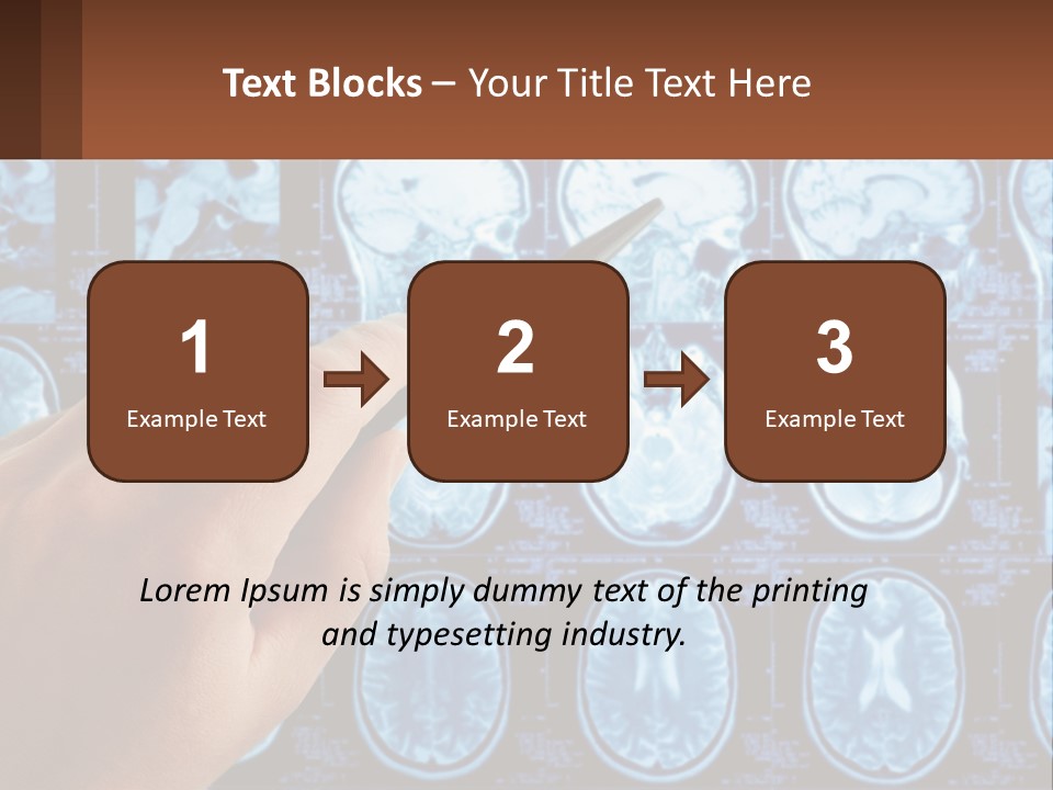 A Person Holding A Pen In Front Of A Brain Scan PowerPoint Template