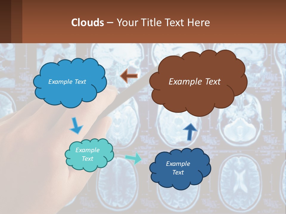 A Person Holding A Pen In Front Of A Brain Scan PowerPoint Template