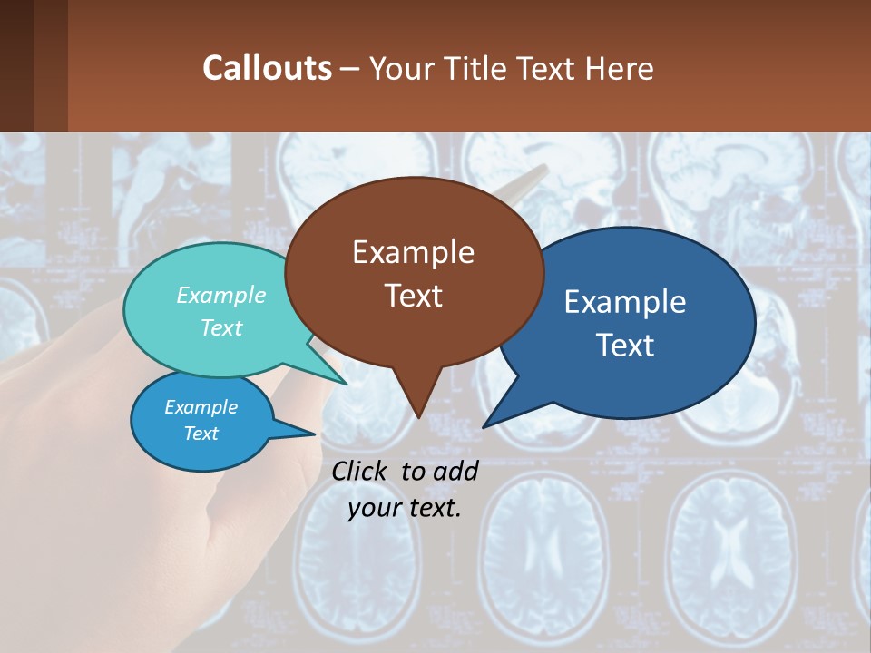 A Person Holding A Pen In Front Of A Brain Scan PowerPoint Template