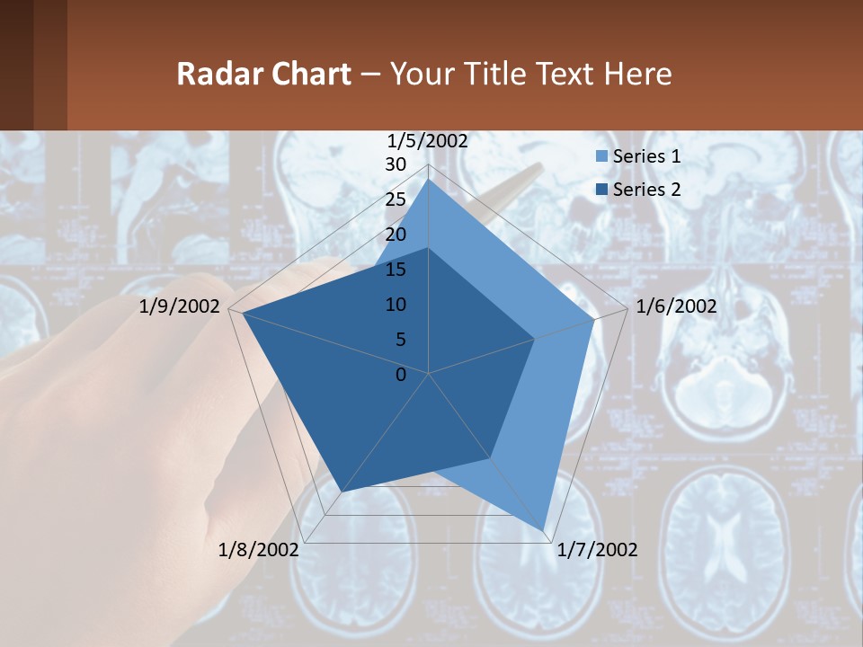 A Person Holding A Pen In Front Of A Brain Scan PowerPoint Template