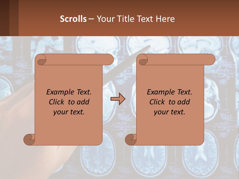 A Person Holding A Pen In Front Of A Brain Scan PowerPoint Template