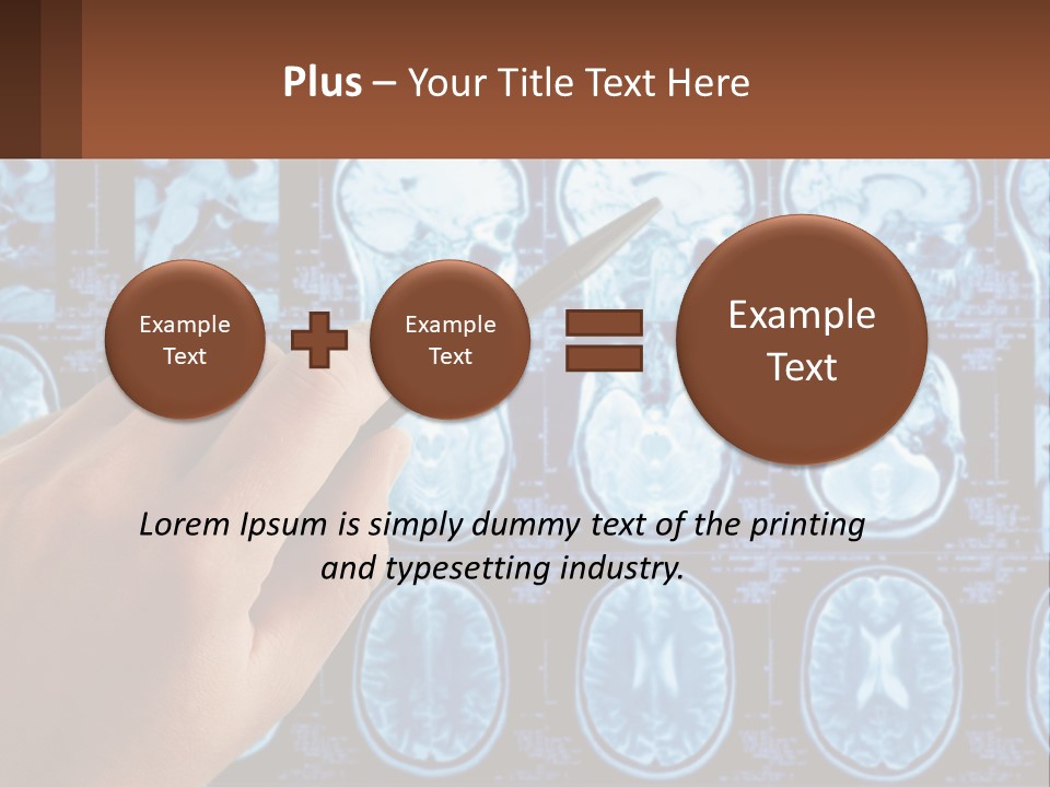 A Person Holding A Pen In Front Of A Brain Scan PowerPoint Template