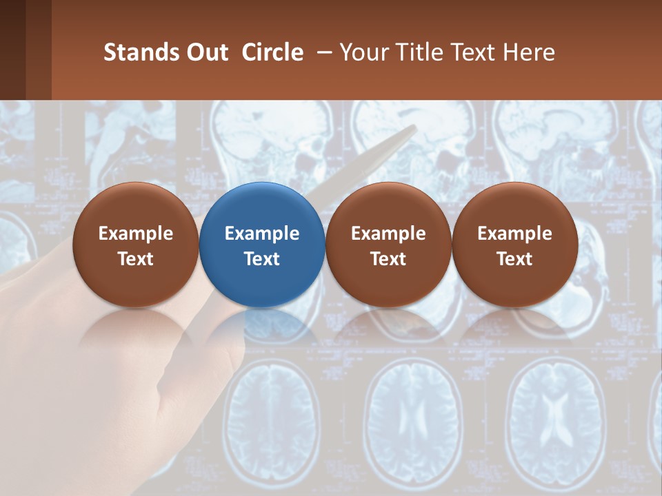 A Person Holding A Pen In Front Of A Brain Scan PowerPoint Template