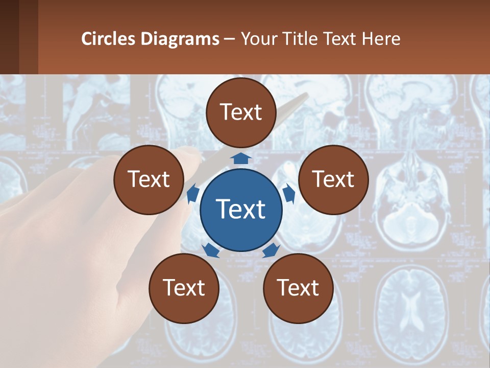 A Person Holding A Pen In Front Of A Brain Scan PowerPoint Template