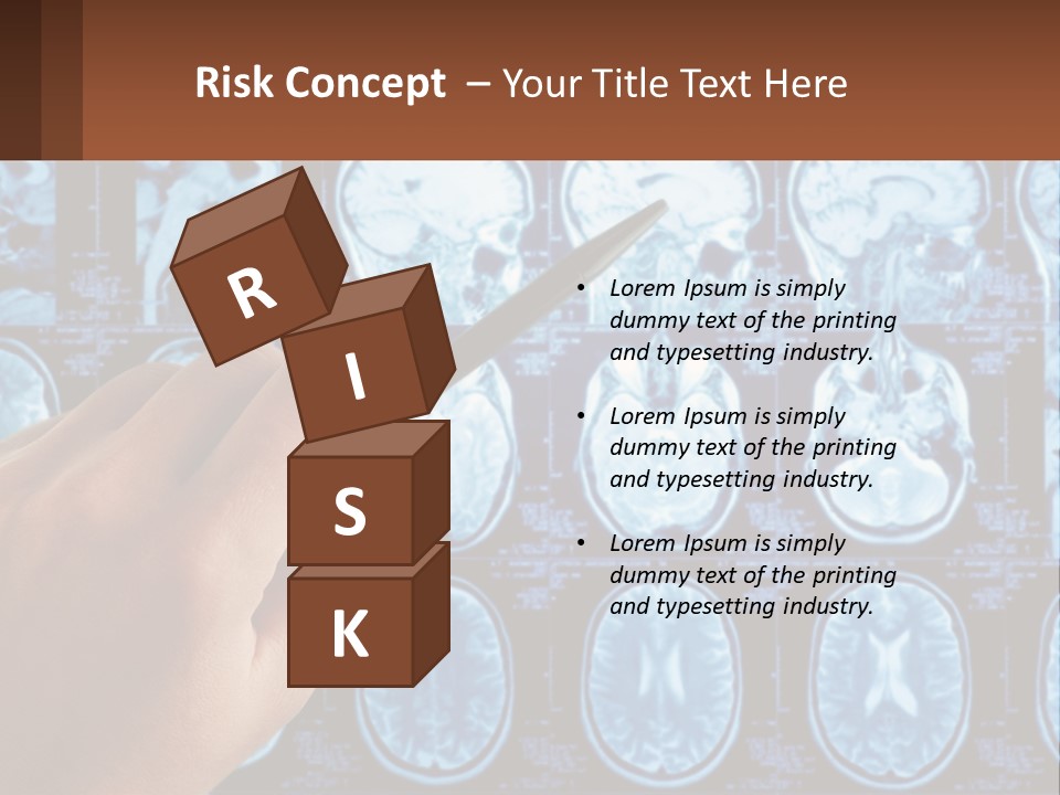 A Person Holding A Pen In Front Of A Brain Scan PowerPoint Template