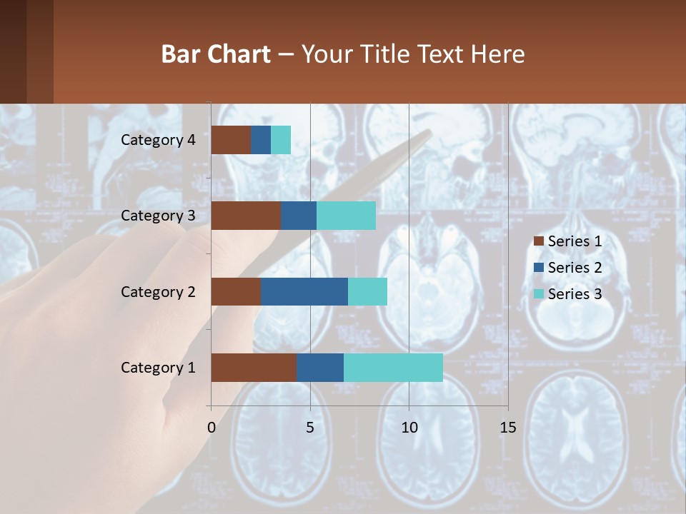 A Person Holding A Pen In Front Of A Brain Scan PowerPoint Template