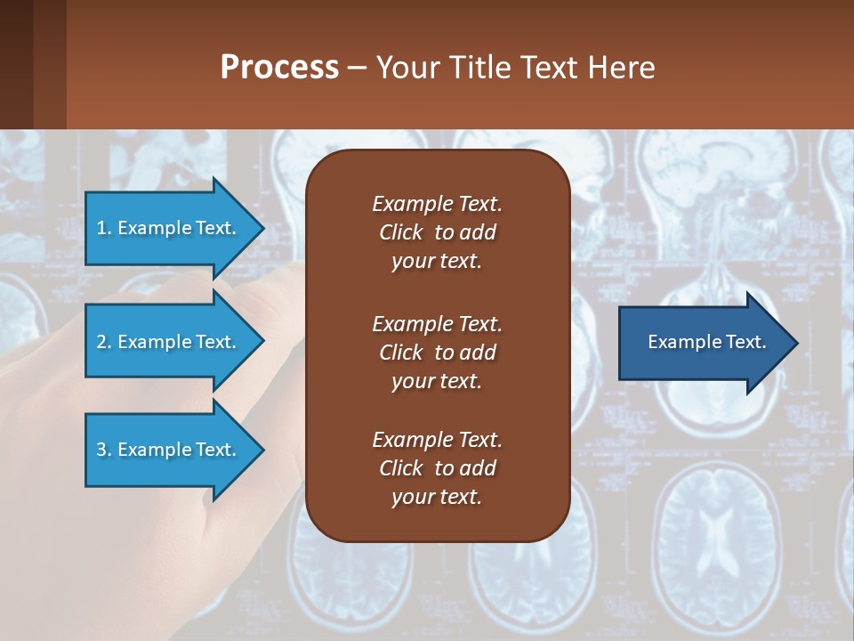 A Person Holding A Pen In Front Of A Brain Scan PowerPoint Template