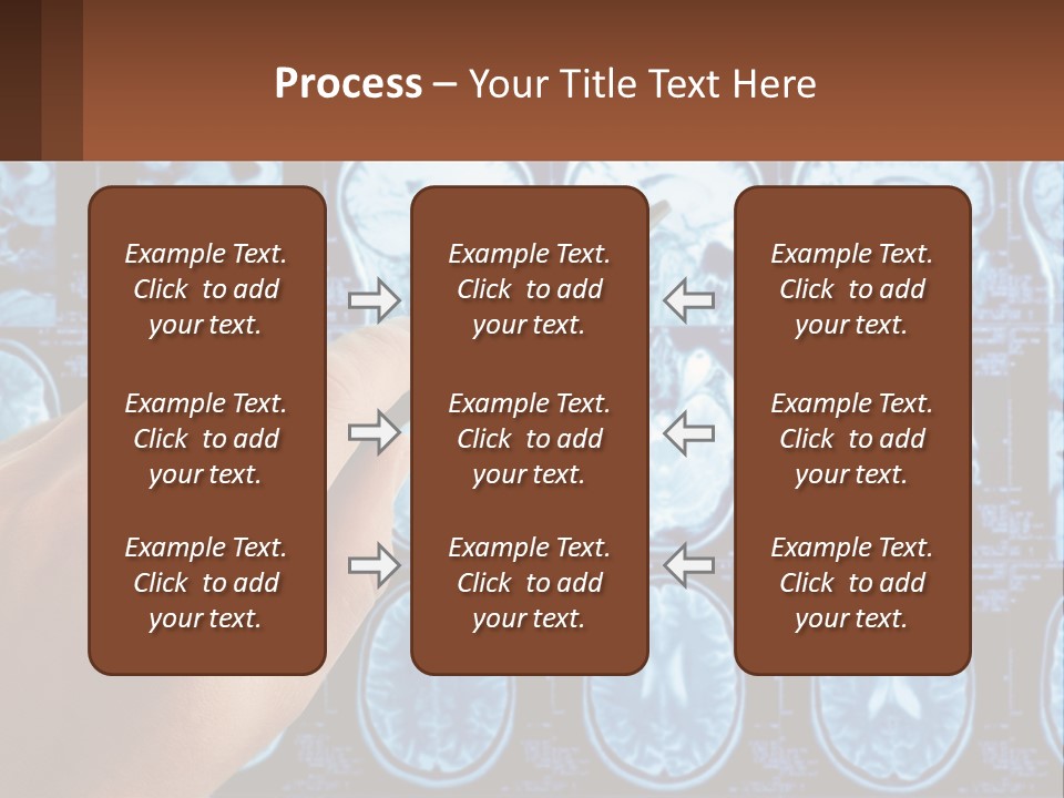 A Person Holding A Pen In Front Of A Brain Scan PowerPoint Template