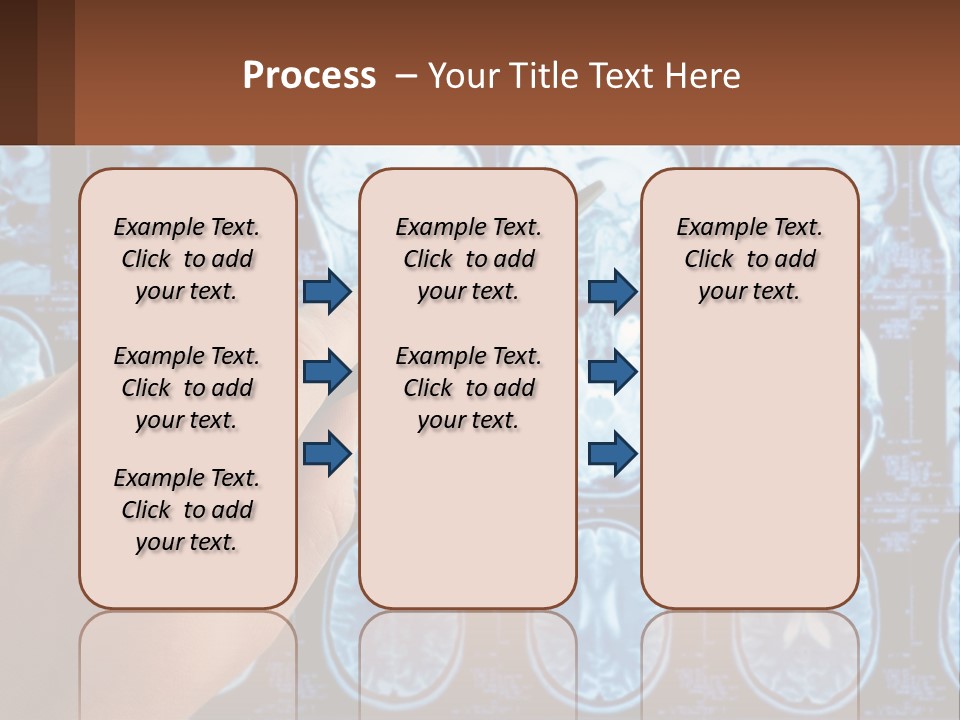 A Person Holding A Pen In Front Of A Brain Scan PowerPoint Template