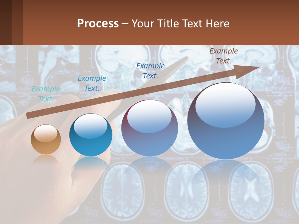 A Person Holding A Pen In Front Of A Brain Scan PowerPoint Template