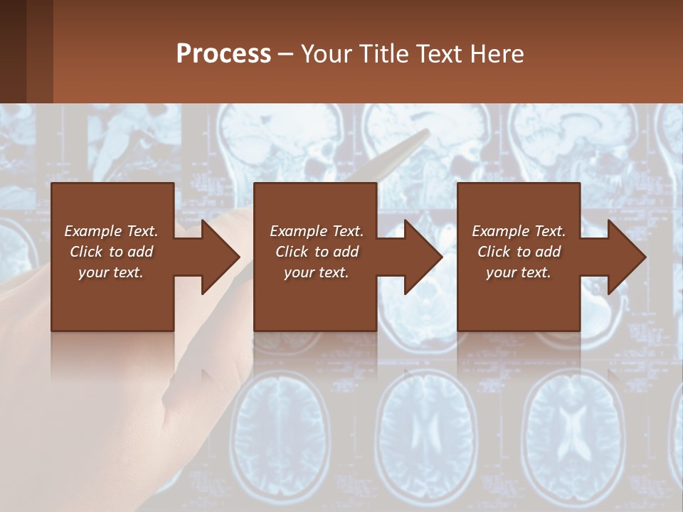 A Person Holding A Pen In Front Of A Brain Scan PowerPoint Template