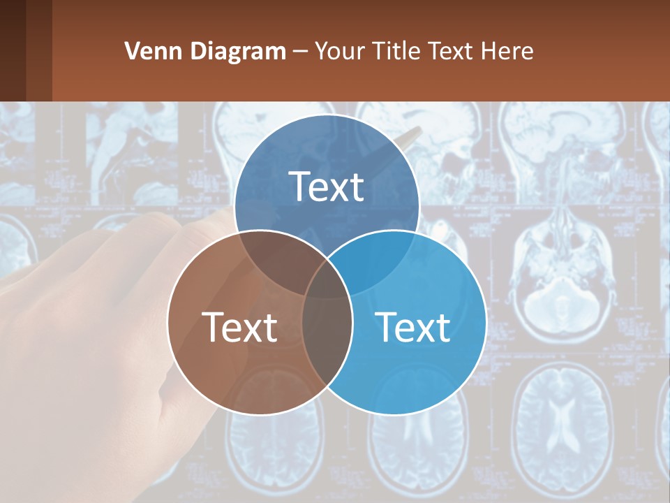 A Person Holding A Pen In Front Of A Brain Scan PowerPoint Template