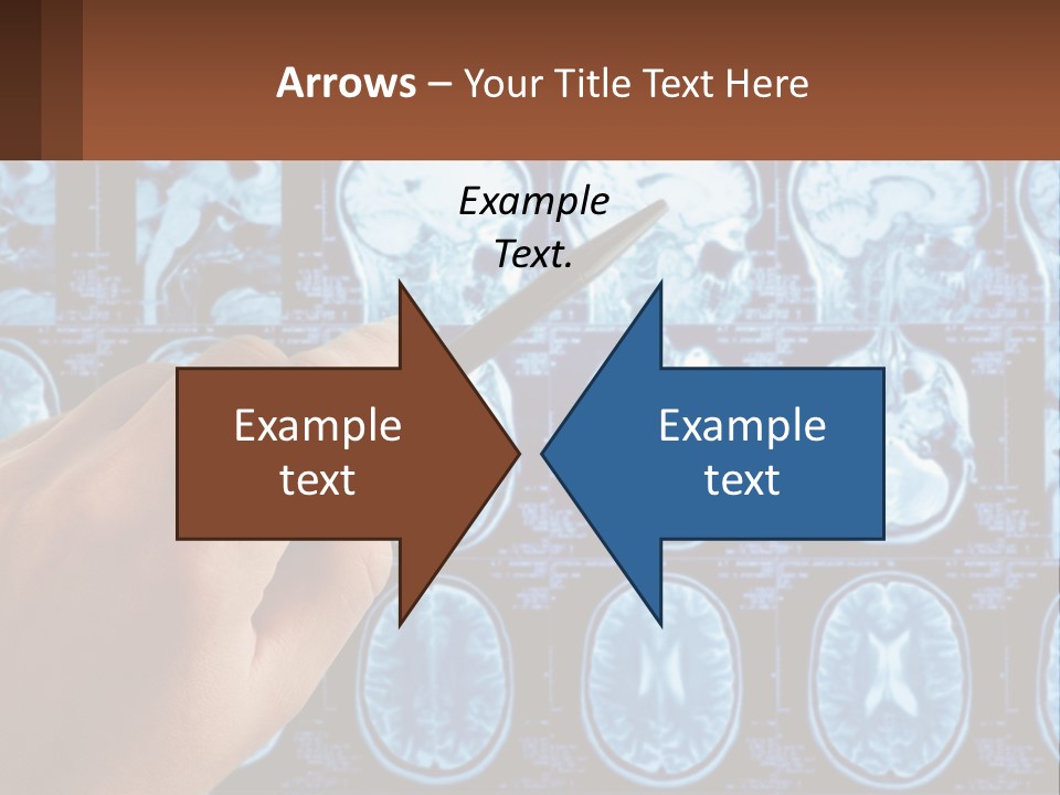 A Person Holding A Pen In Front Of A Brain Scan PowerPoint Template