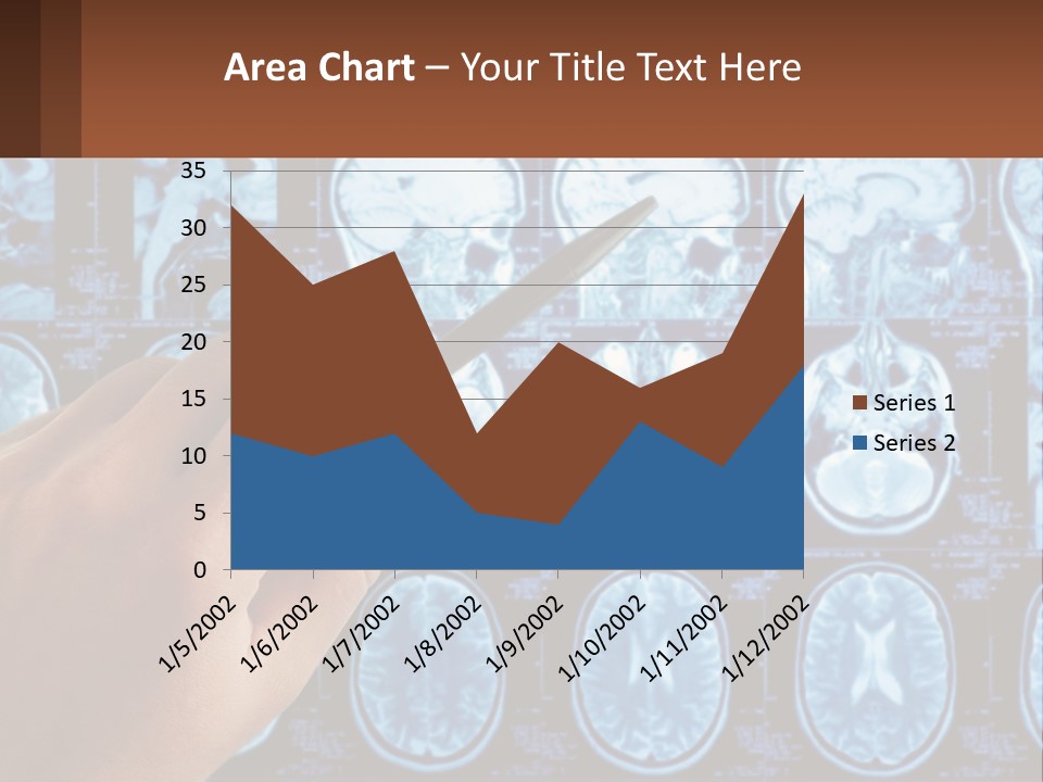 A Person Holding A Pen In Front Of A Brain Scan PowerPoint Template