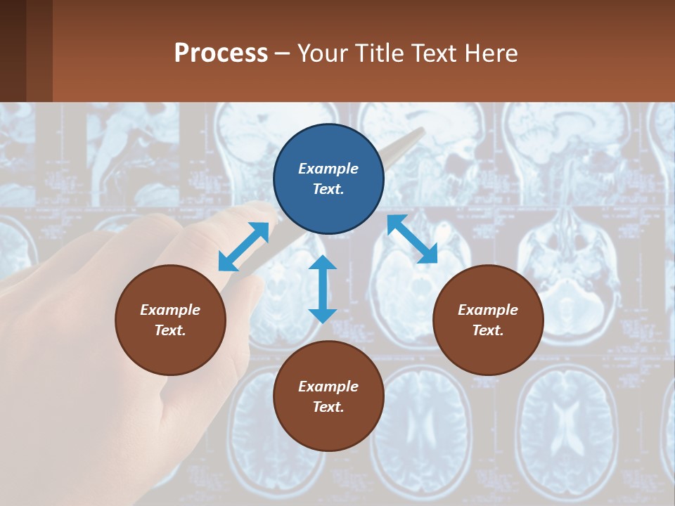 A Person Holding A Pen In Front Of A Brain Scan PowerPoint Template