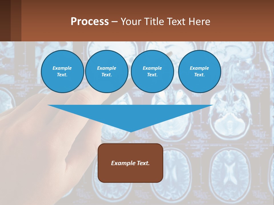 A Person Holding A Pen In Front Of A Brain Scan PowerPoint Template