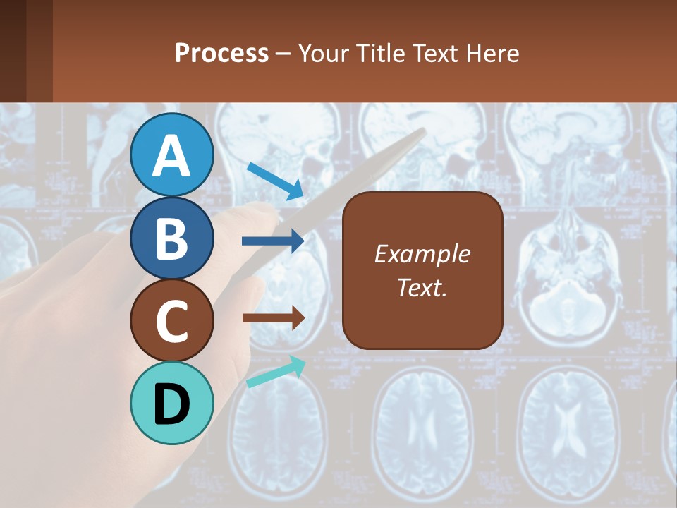 A Person Holding A Pen In Front Of A Brain Scan PowerPoint Template