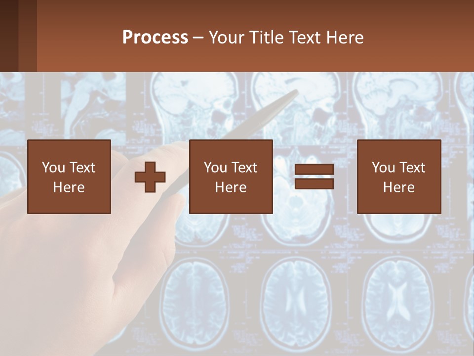 A Person Holding A Pen In Front Of A Brain Scan PowerPoint Template