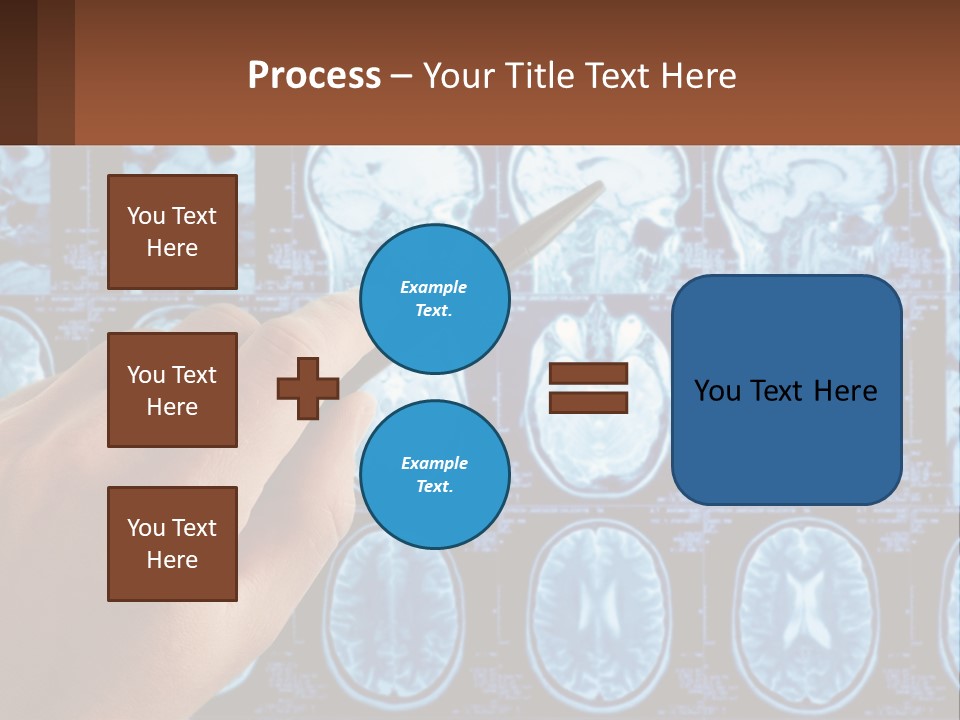 A Person Holding A Pen In Front Of A Brain Scan PowerPoint Template