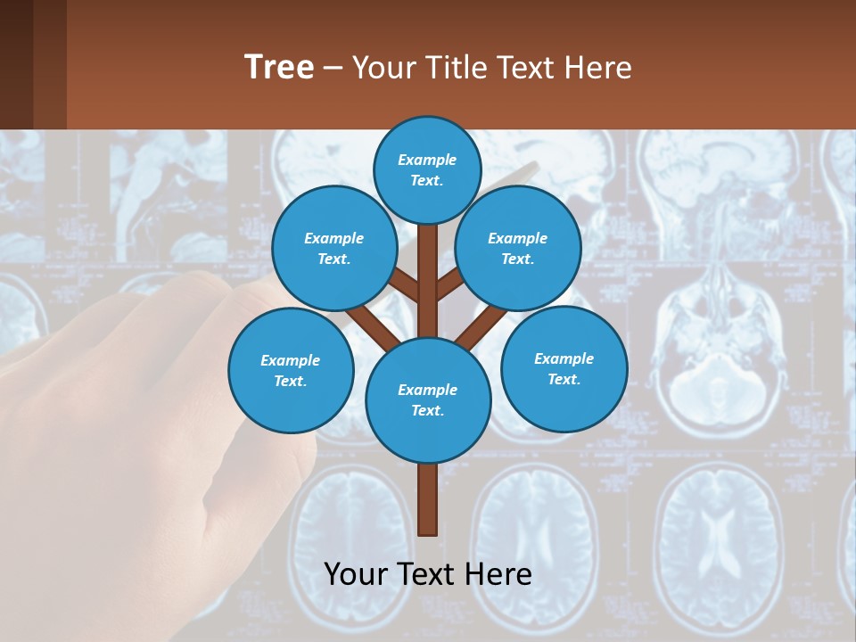 A Person Holding A Pen In Front Of A Brain Scan PowerPoint Template