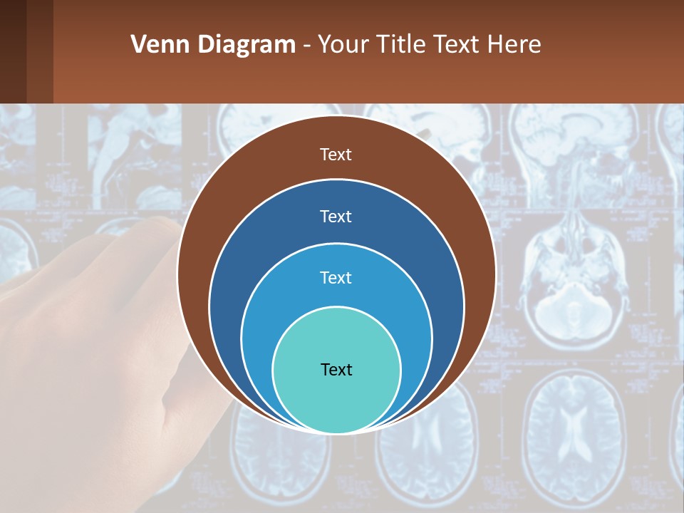 A Person Holding A Pen In Front Of A Brain Scan PowerPoint Template