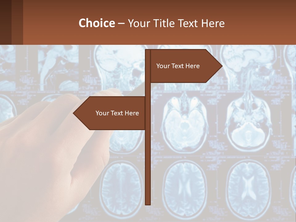 A Person Holding A Pen In Front Of A Brain Scan PowerPoint Template