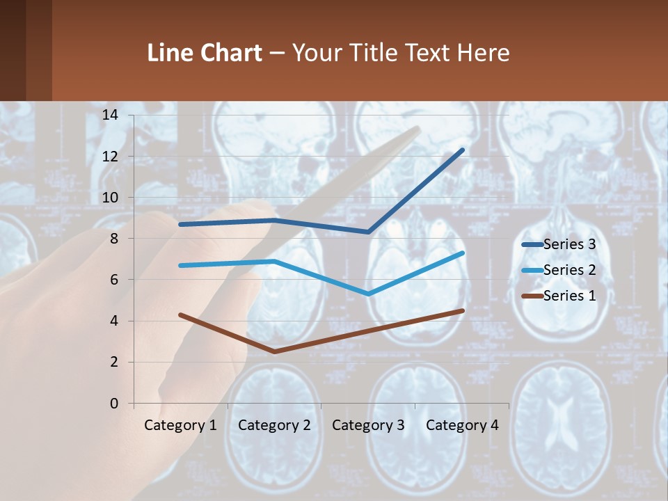A Person Holding A Pen In Front Of A Brain Scan PowerPoint Template