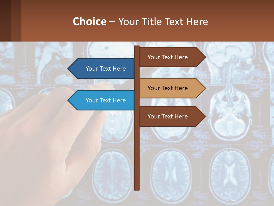 A Person Holding A Pen In Front Of A Brain Scan PowerPoint Template