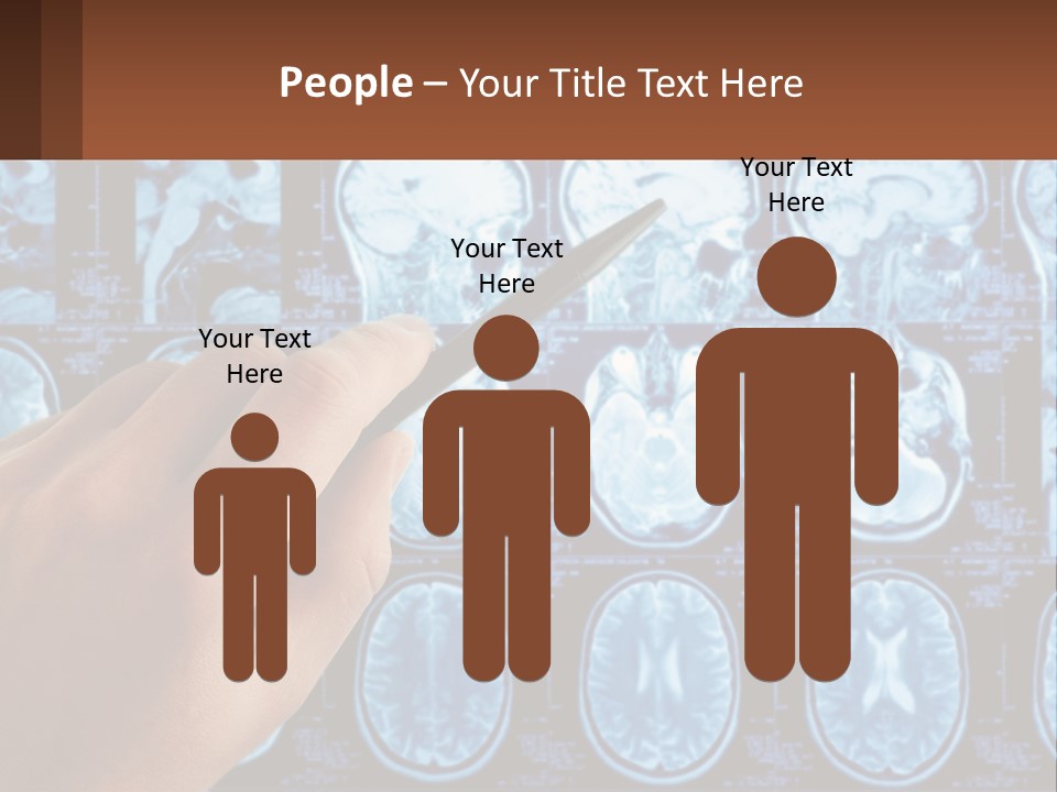 A Person Holding A Pen In Front Of A Brain Scan PowerPoint Template
