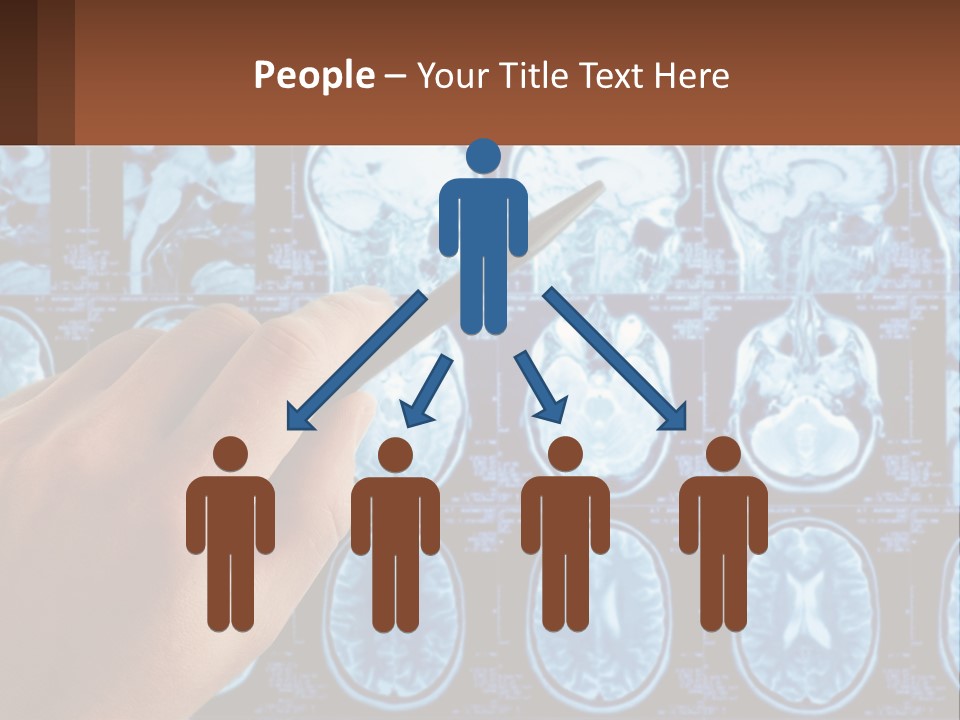 A Person Holding A Pen In Front Of A Brain Scan PowerPoint Template