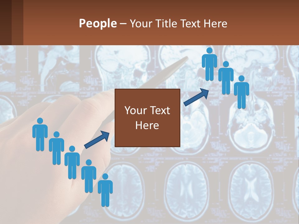 A Person Holding A Pen In Front Of A Brain Scan PowerPoint Template