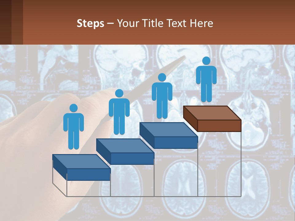A Person Holding A Pen In Front Of A Brain Scan PowerPoint Template