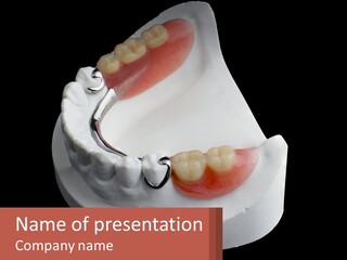 A Dental Model Of A Tooth With A Missing Tooth PowerPoint Template