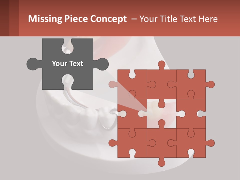 A Dental Model Of A Tooth With A Missing Tooth PowerPoint Template