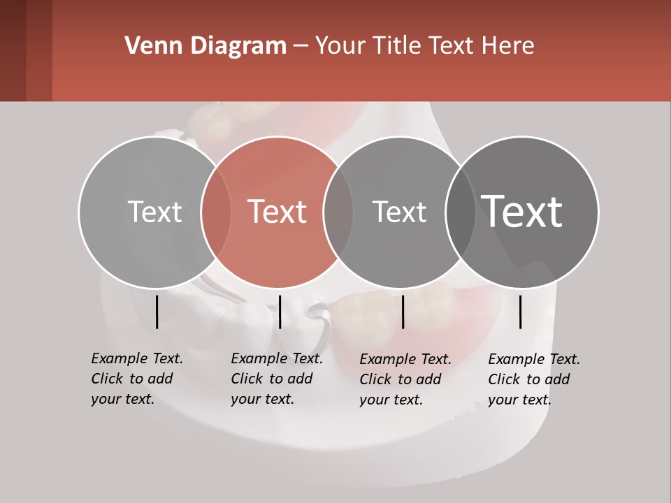 A Dental Model Of A Tooth With A Missing Tooth PowerPoint Template